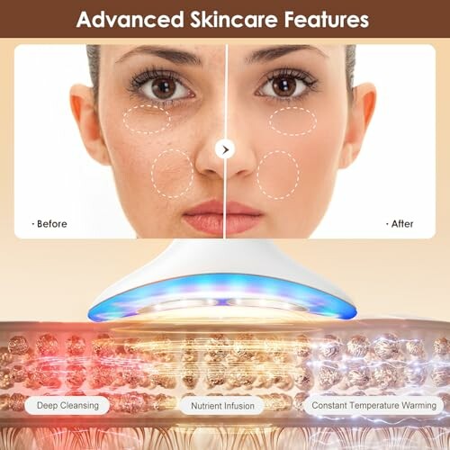 Before and after skincare comparison with device features.