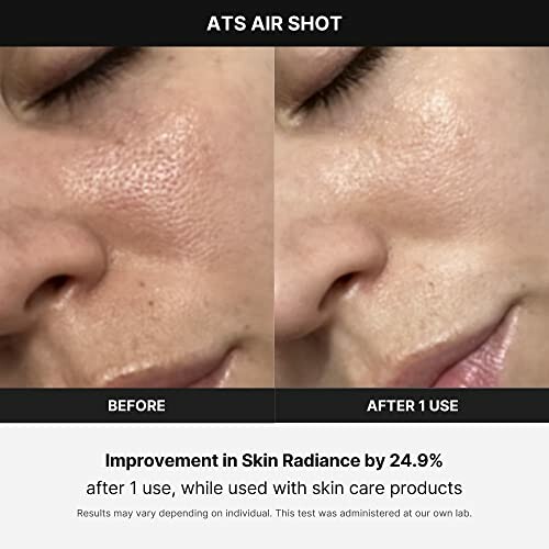 Before and after skin improvement image with ATS Air Shot.
