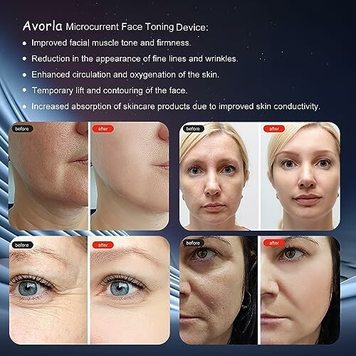 Avorla Microcurrent Face Toning Device benefits and before-after results.