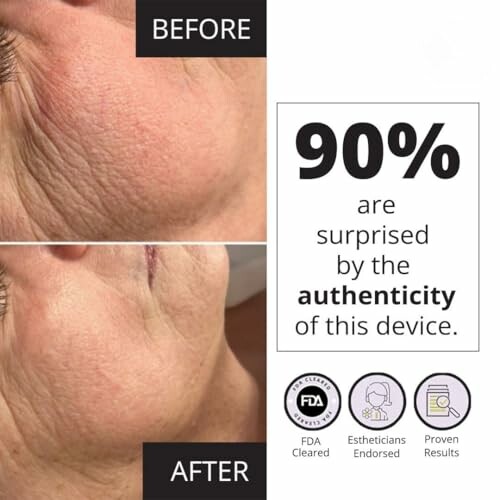Before and after skincare results with device authenticity claim.