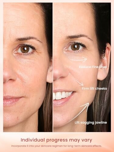 Before and after skincare comparison with highlighted improvements.