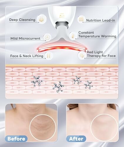 Infographic of facial therapy device benefits with before and after images.