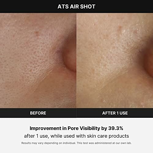 Comparison of skin pores before and after using a skincare product.