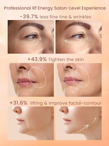 Comparison of skin improvements with RF energy treatment.